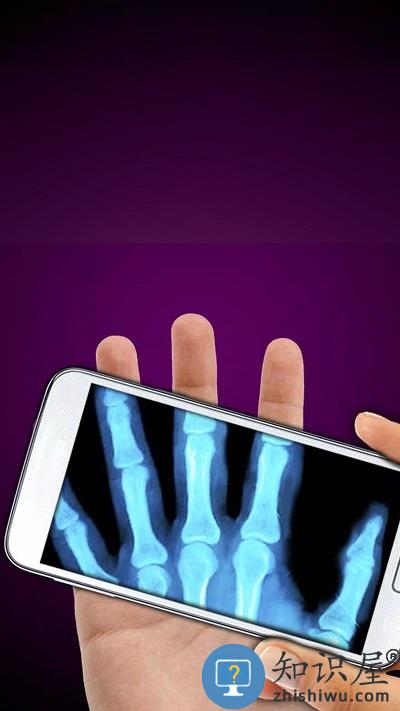 x射线模拟器手机版下载